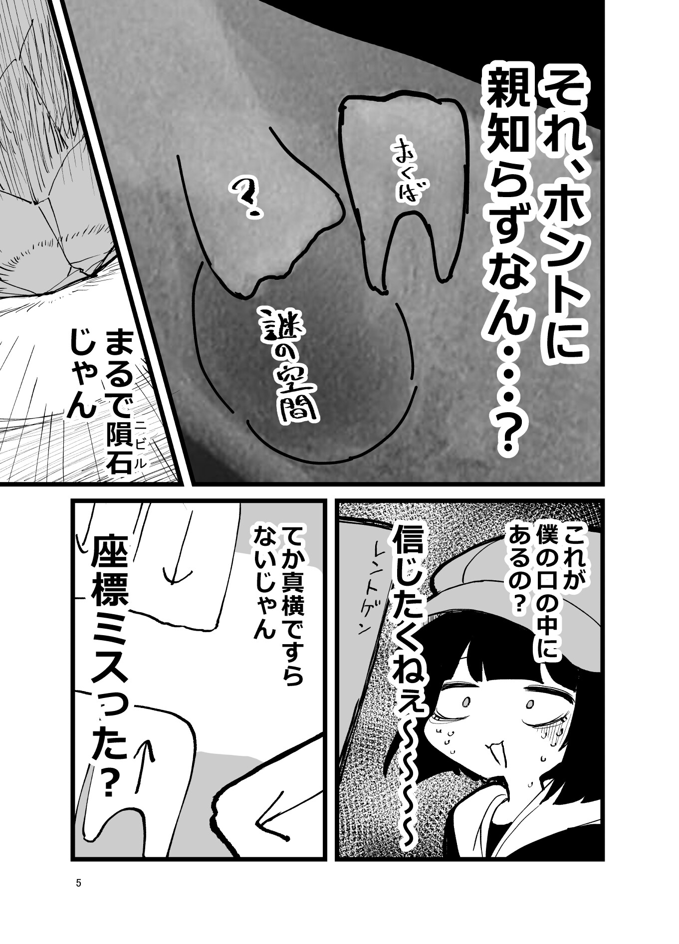 [実録]ふんぼの親知らずがありえん向きで 生えたせいで全身麻酔手術した話 画像3