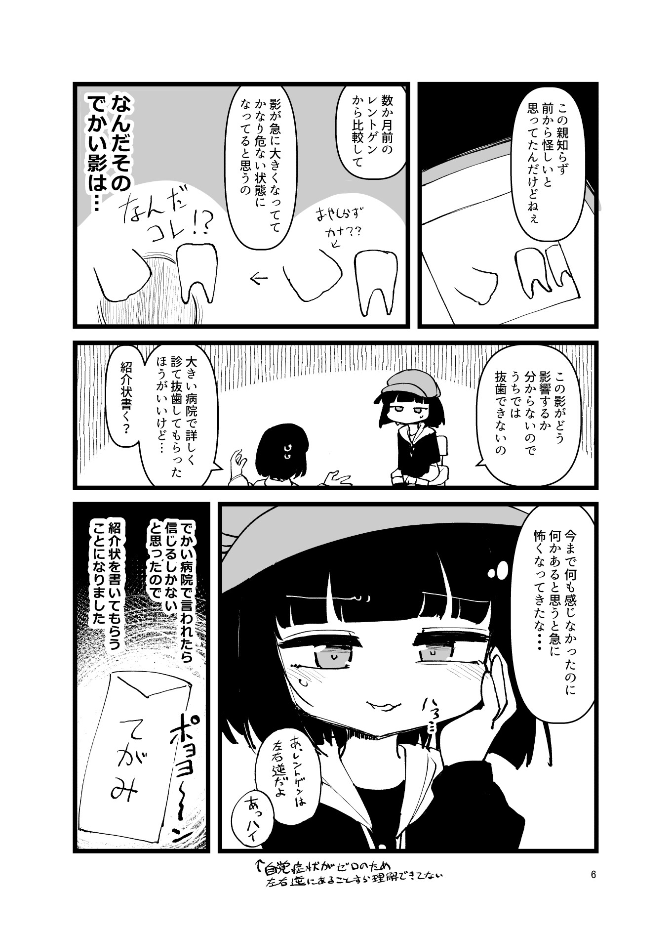 [実録]ふんぼの親知らずがありえん向きで 生えたせいで全身麻酔手術した話 画像4