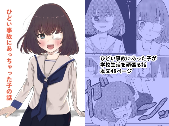 ひどい事故にあっちゃった子の話 [ハンティングナイフ] 