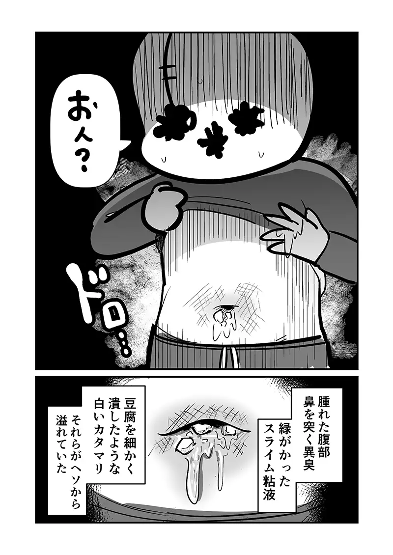〆切に追われて栄養剤+仮眠を繰り返していたらおヘソから膿が出て入院した話2 サンプル画像 5