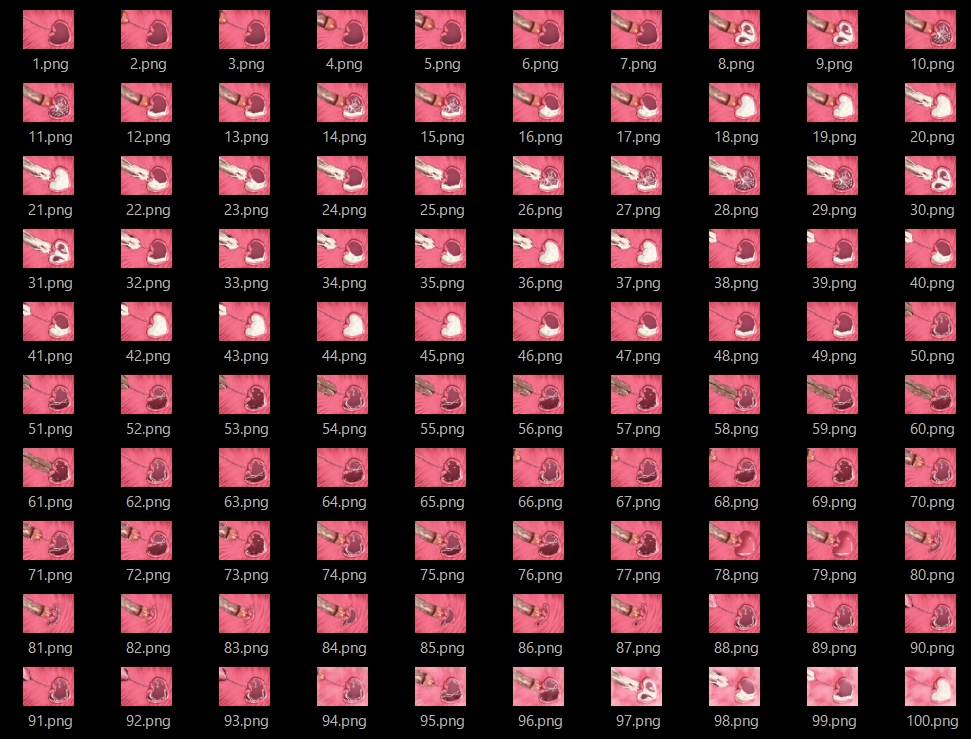 膣内断面図素材3