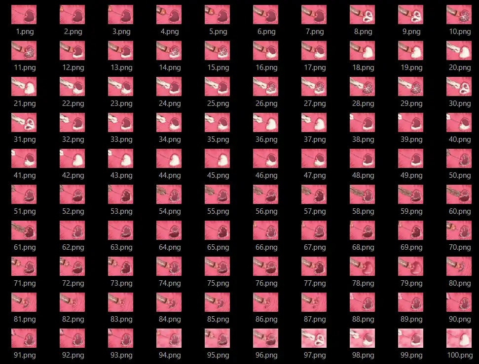 膣内断面図素材3 サンプル画像 8