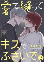 愛で縫ってキスでふさいで（分冊版）　【第3話】 [海王社]