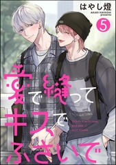 愛で縫ってキスでふさいで（分冊版）　【第5話】 [海王社]