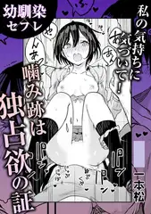 私の気持ちに気づいて!噛み跡は独占欲の証