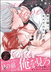 【期間限定　試し読み増量版】愛で縫ってキスでふさいで【電子限定かきおろし漫画2P付】 [海王社]