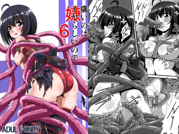 痛いのはイヤらしいので6 [サーティセイバーストリート]