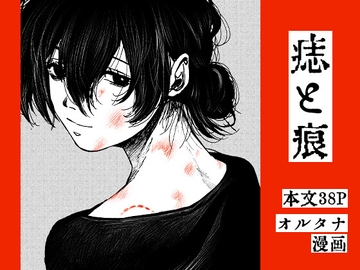 痣と痕 [その線には色がない]