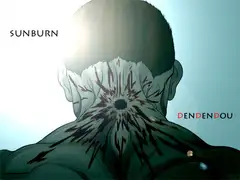 SUNBURN