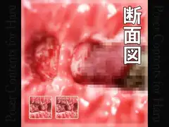 Sectional View of Vaginal for Haru