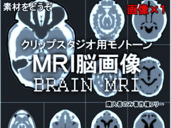 素材をどうぞ『MRI脳画像』